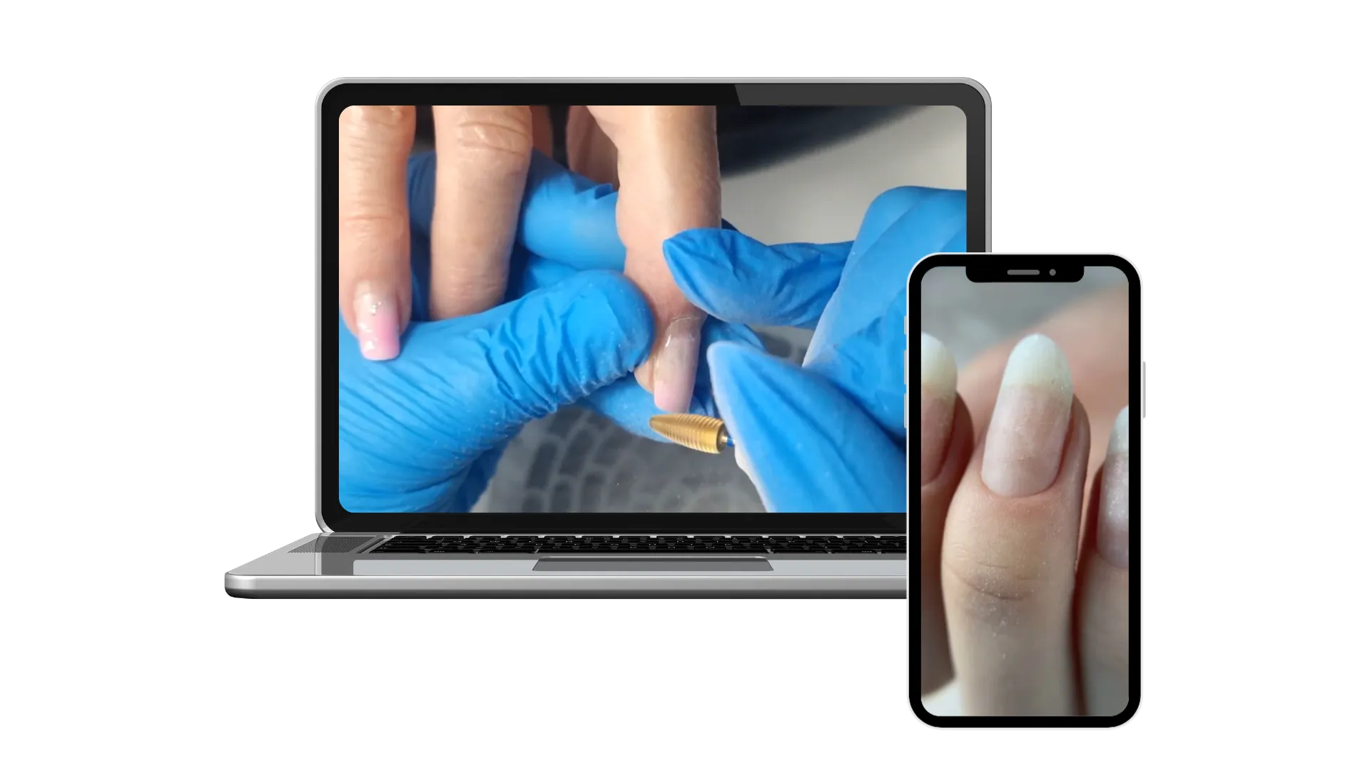 Refill Removal Pro